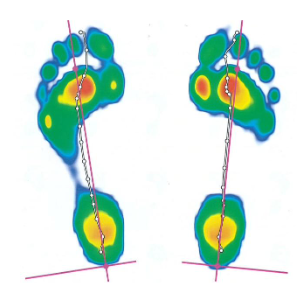 services-02 Footscan Plantar Pressure Data
