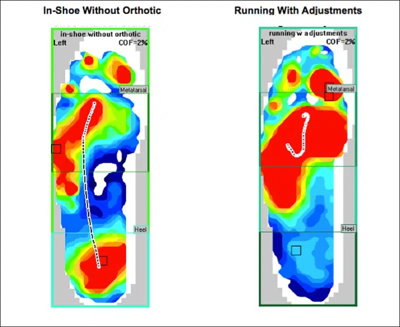 Runing With Orthotics.jpg